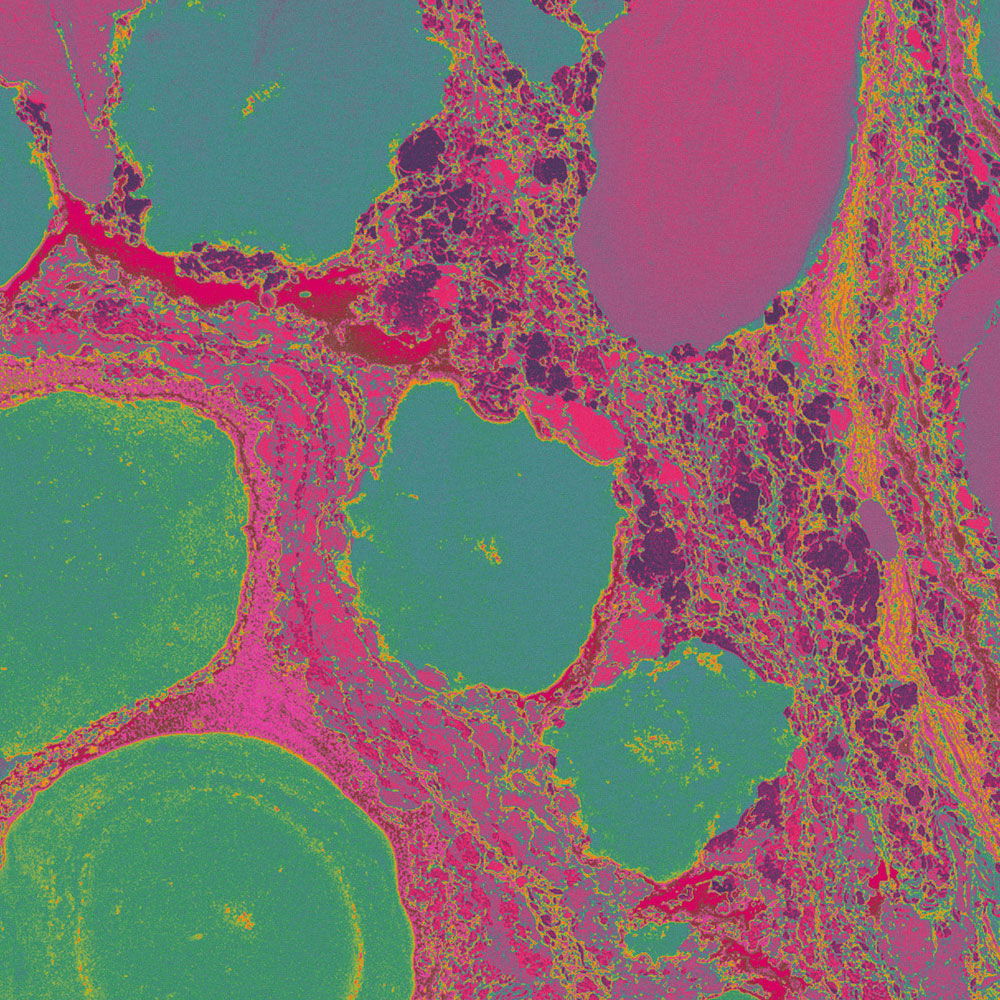 walls by patel Фотообои Walls by Patel 4